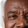 skin aging